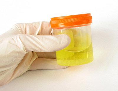 How To Pass Weed Urine Test